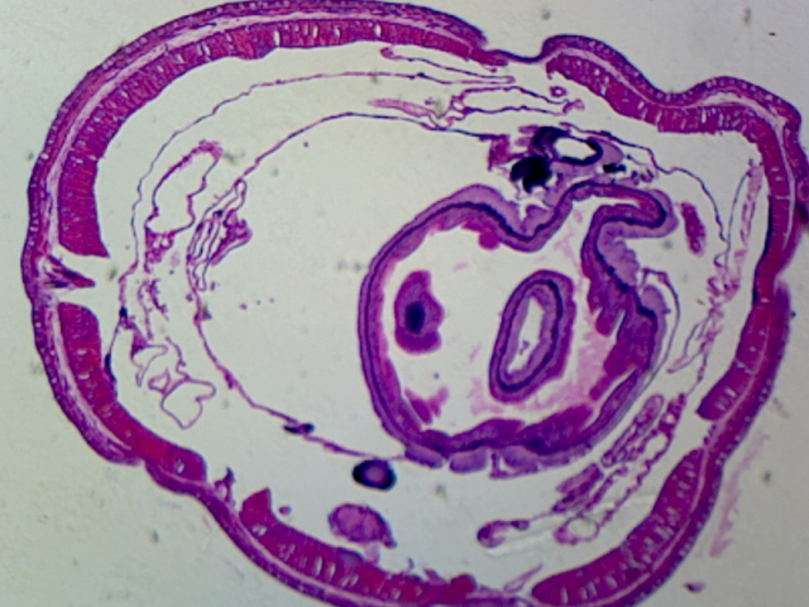 Microscope Slide, Earthworms Setae C.S. M-Stain.