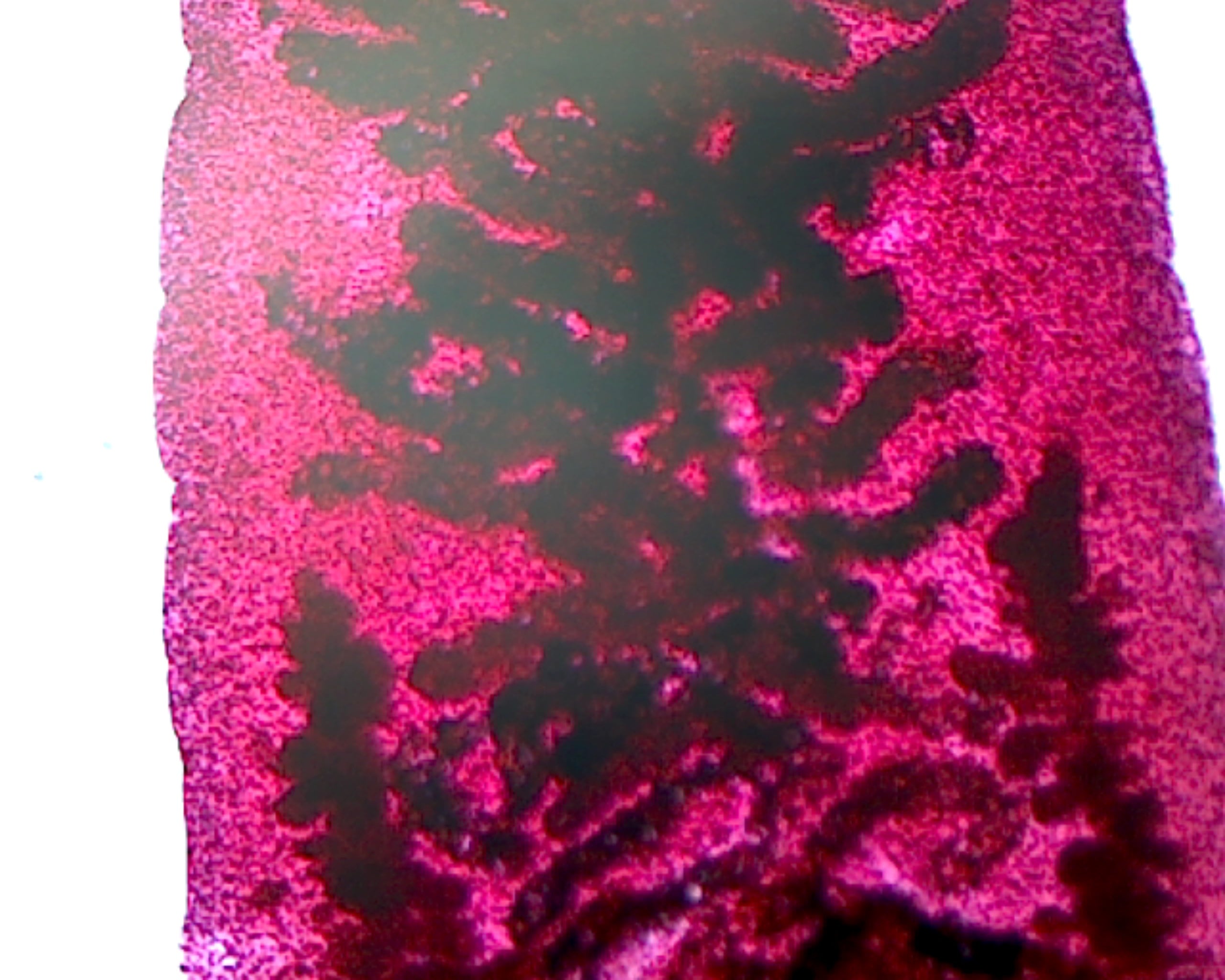 Microscope Slide, Fasciola Hepatica, W.M.