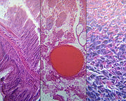 Microscope Slide, Earthworm, Composite, C.S. Section through Pharynx, intestine, head region