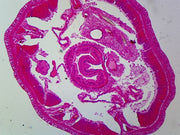 Microscope Slide, Annelids, Earthworm, C.S.