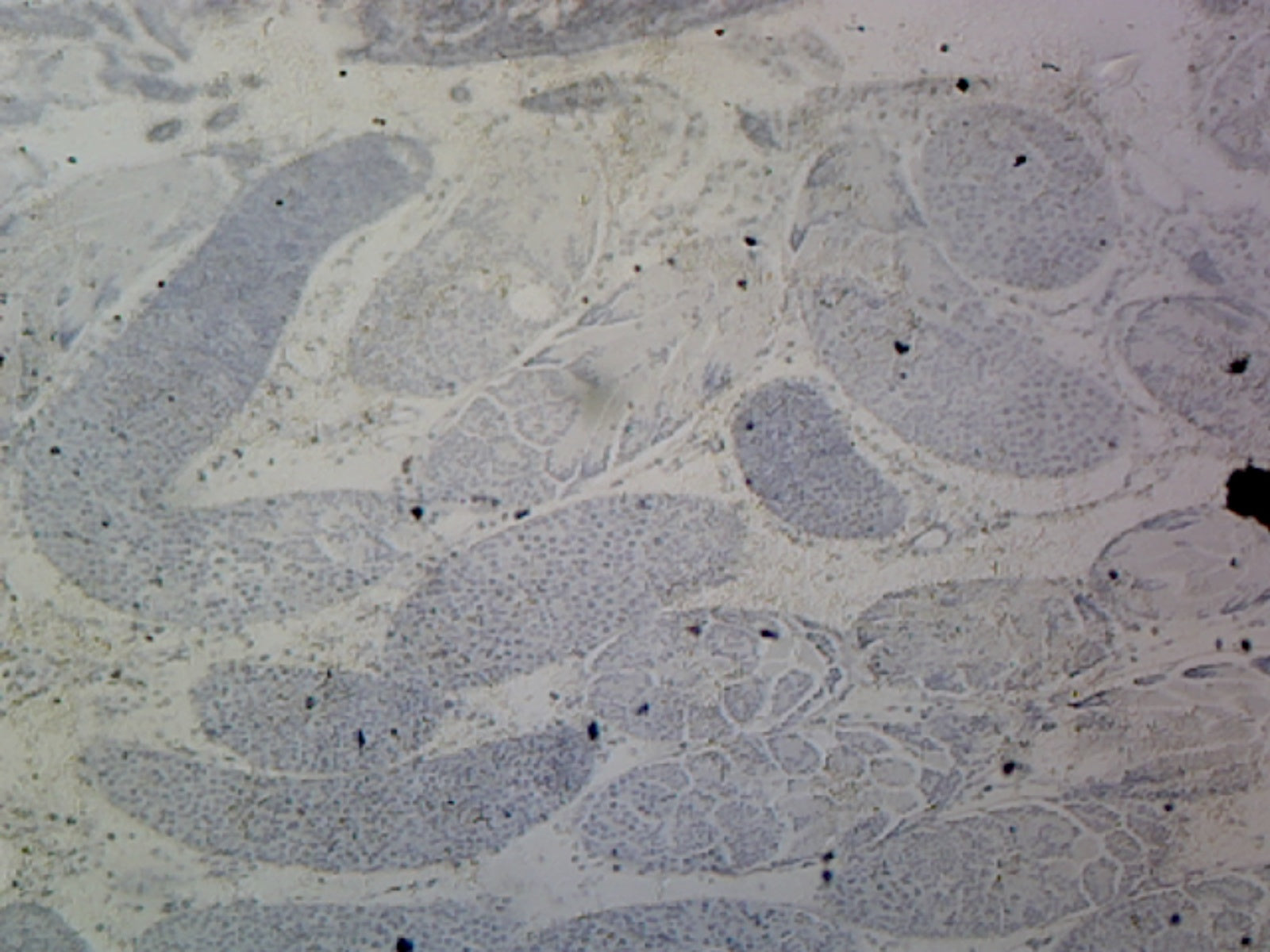 Microscope Slide, Grasshopper Testis W.M.