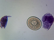 Microscope Slide, Rotifers Mixed, W.M, Fresh Water Species