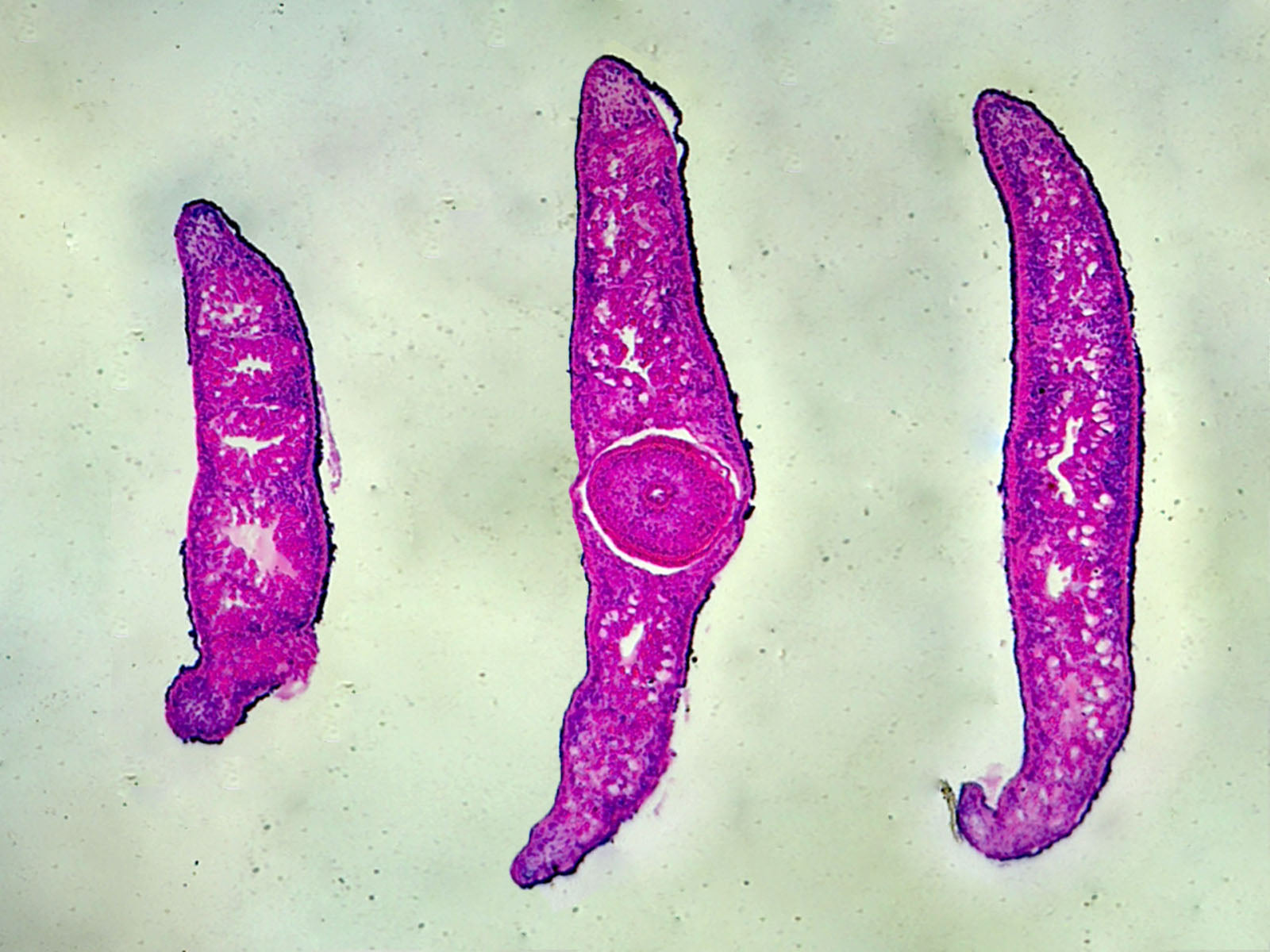Microscope Slide, Planaria, Three Different Regions; Cross Section, Showing Anterior, Middle and Posterior Regions