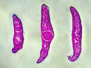 Microscope Slide, Planaria, Three Different Regions; Cross Section, Showing Anterior, Middle and Posterior Regions