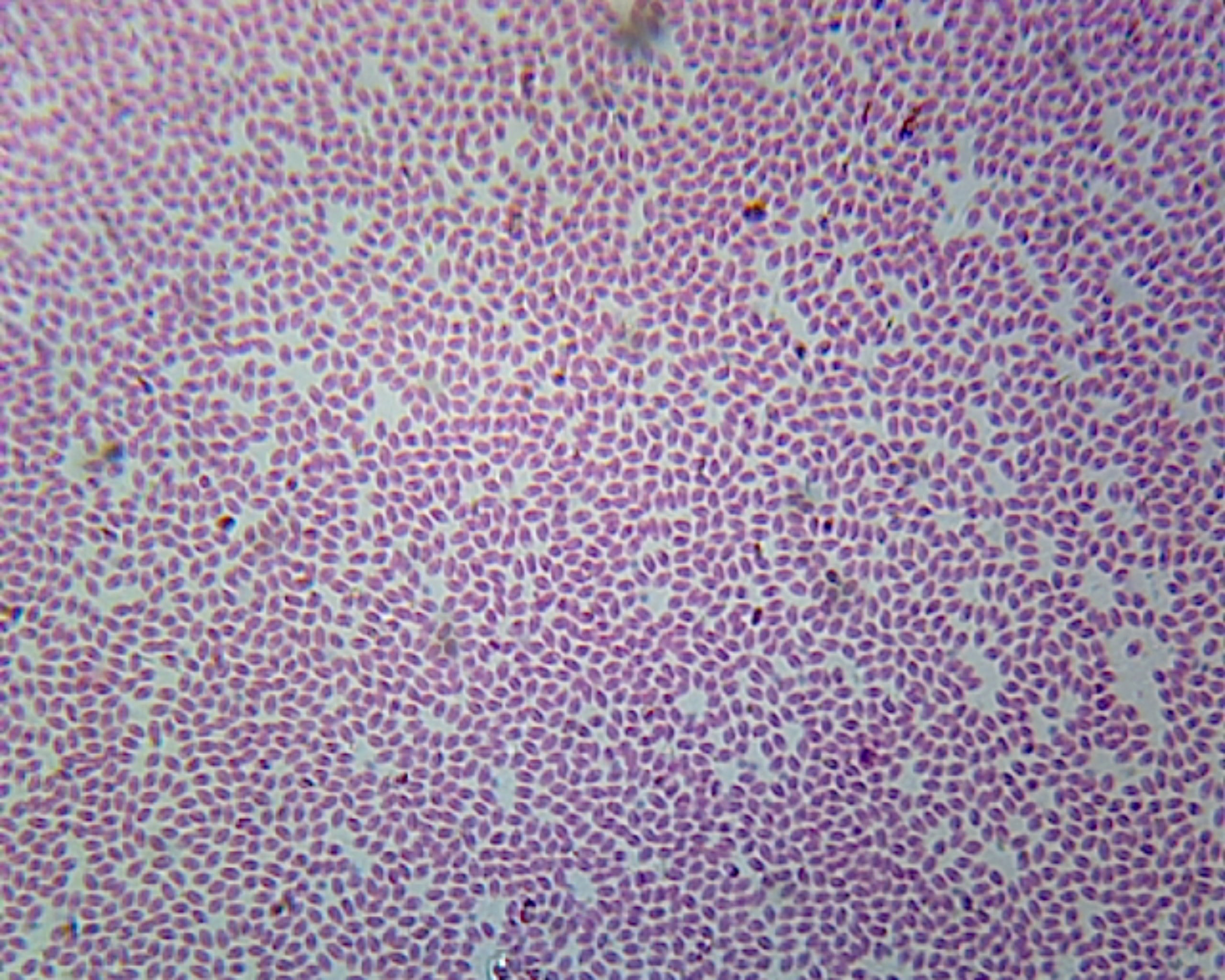 Microscope Slide, Blood Smear Earthworm