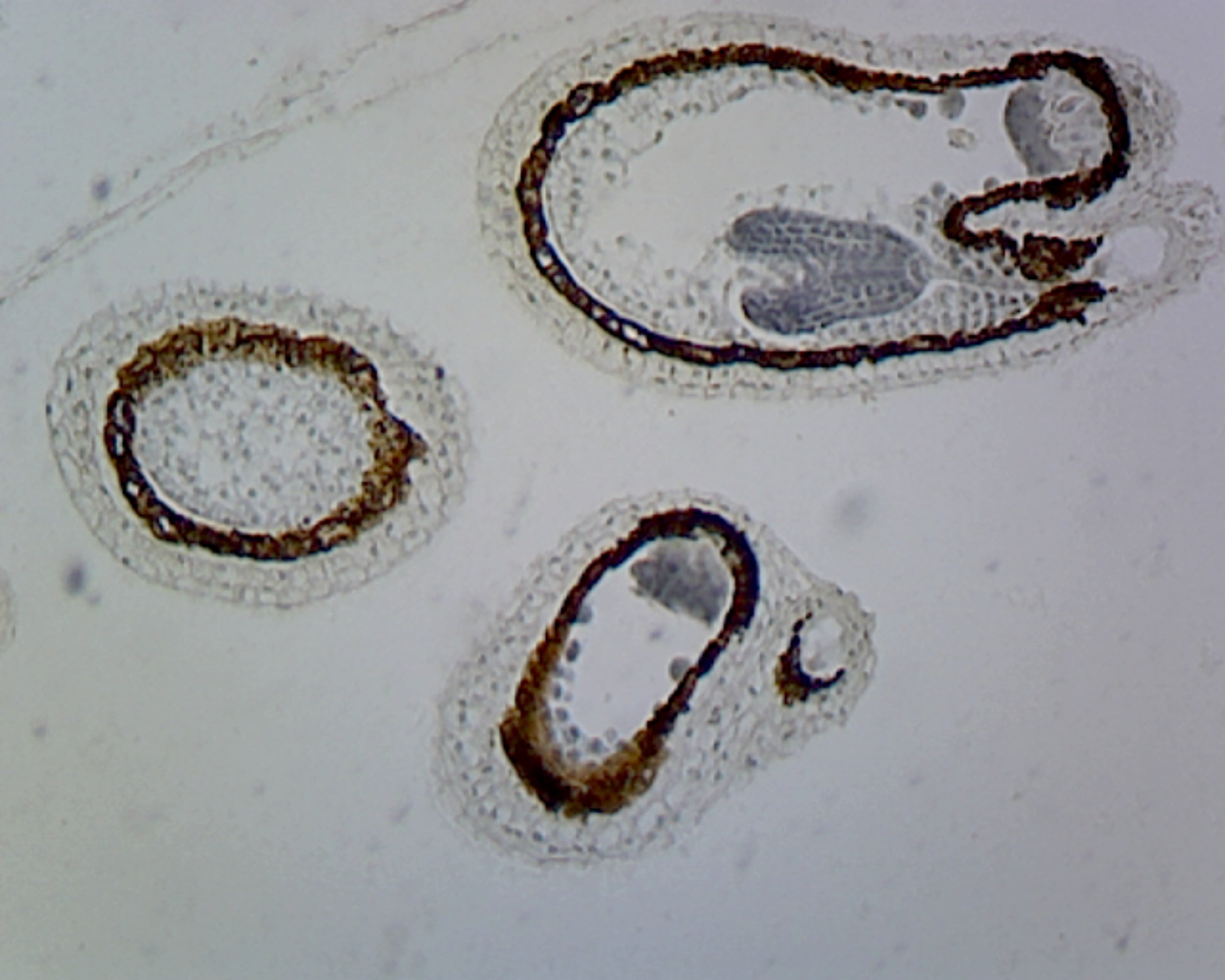 Microscope Slide, Caposella Embryo Precotyledon