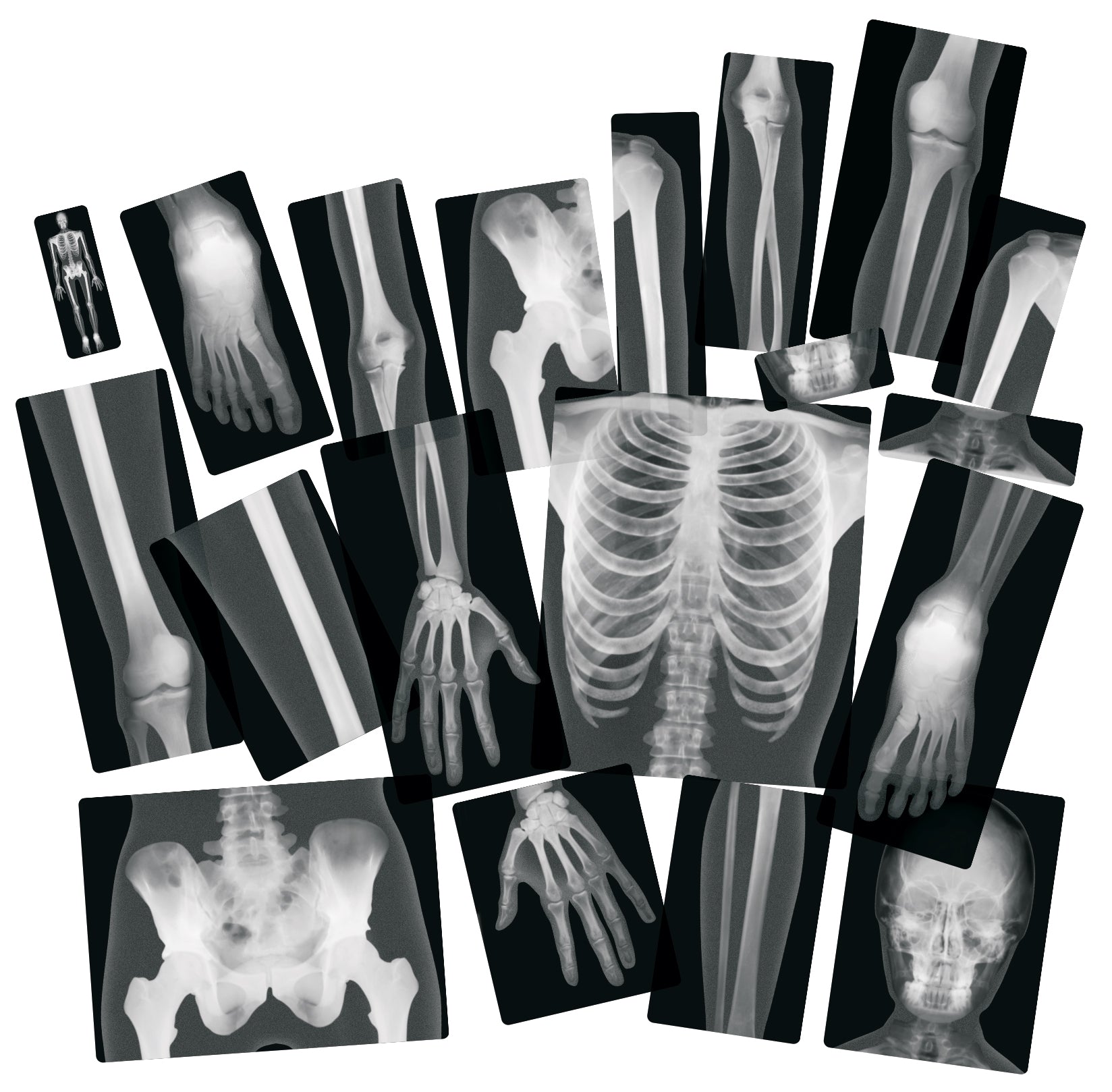 True to Life Human X-Rays®  18/pkg