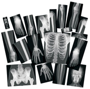 True to Life Human X-Rays®  18/pkg