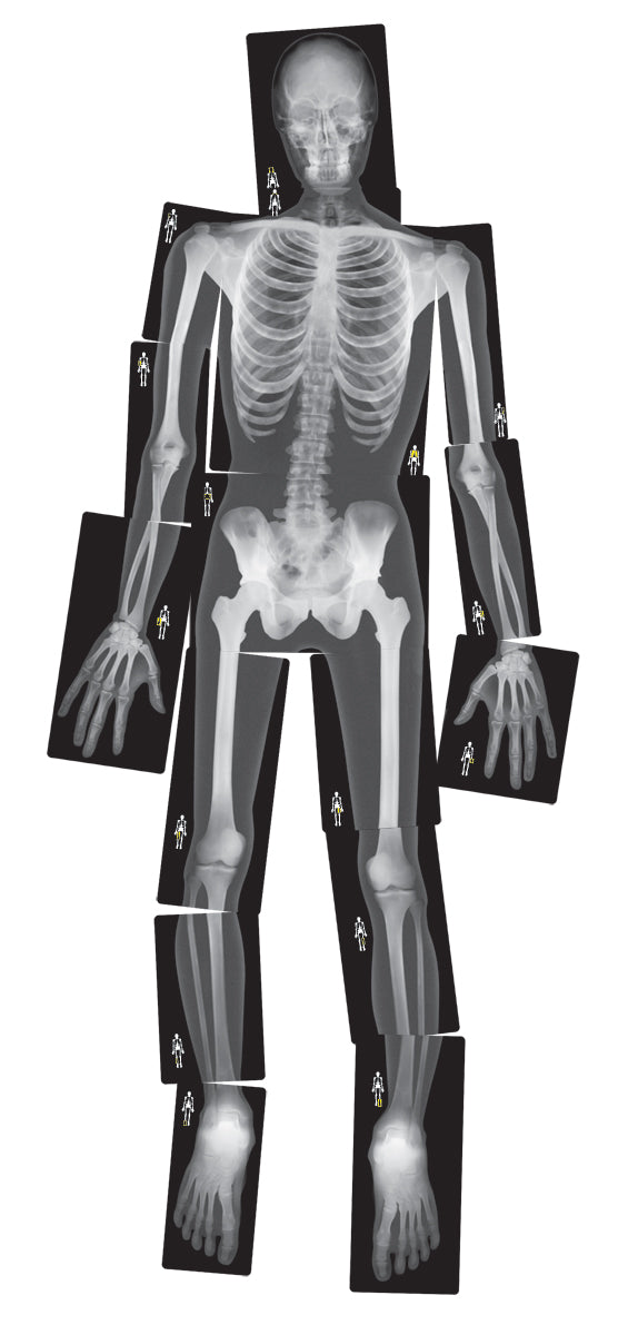 True to Life Human X-Rays®  18/pkg