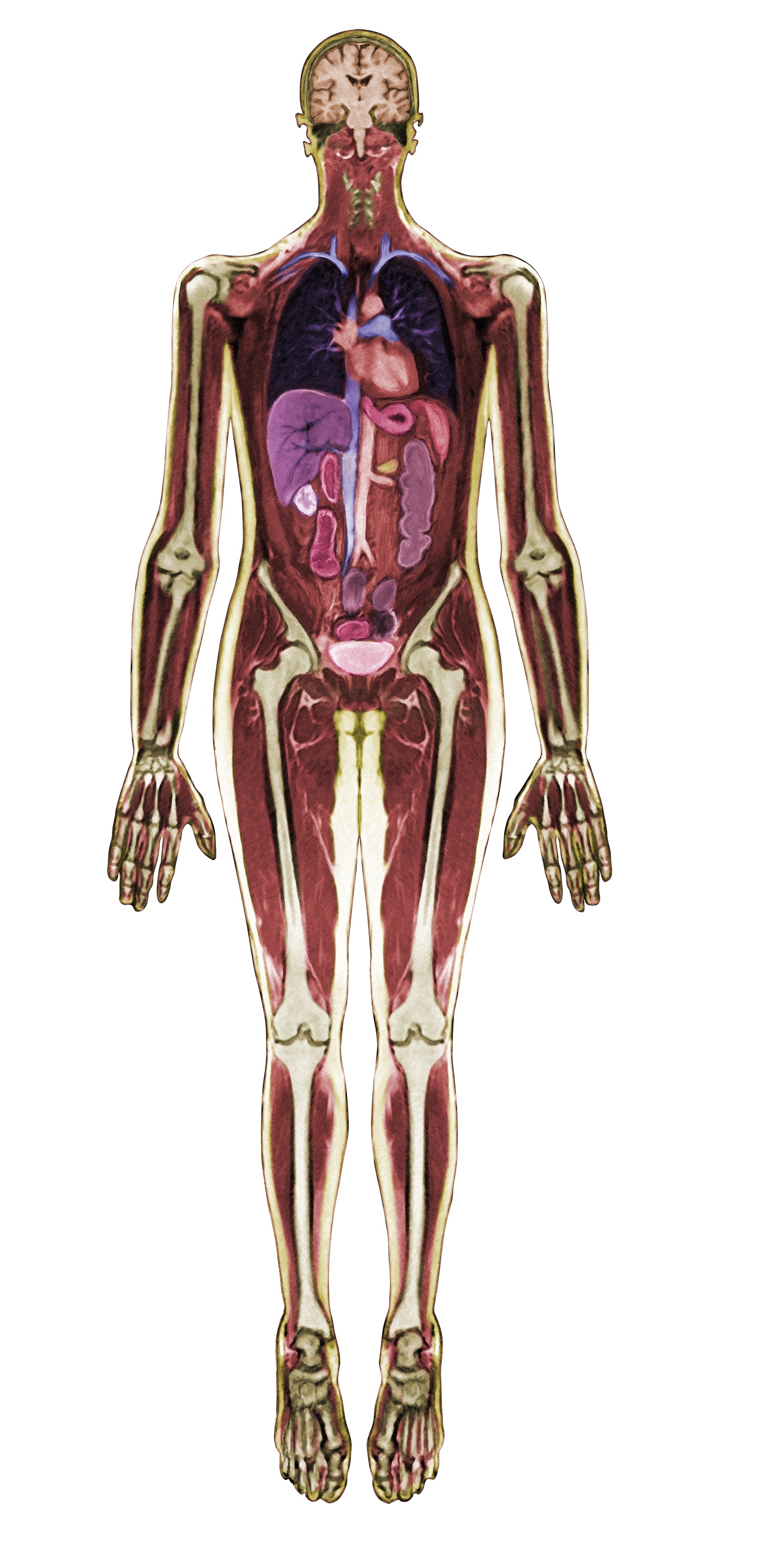 Look Inside Me MRI Scan