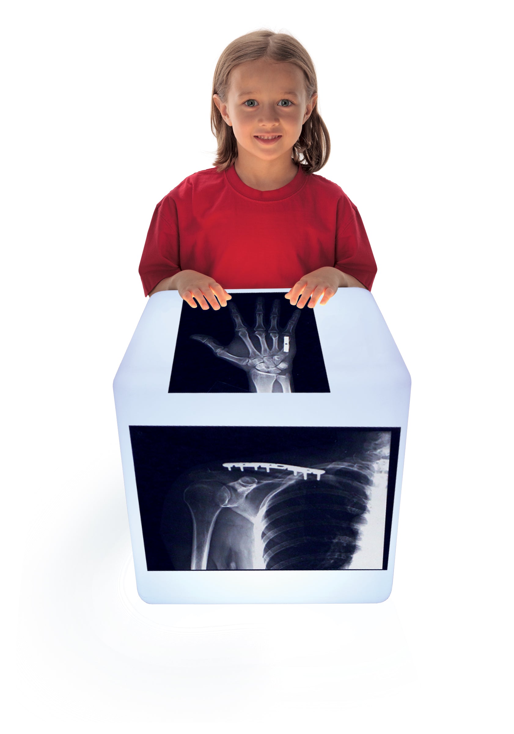Fixed Bones X-Rays