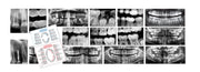 Dental X-Rays