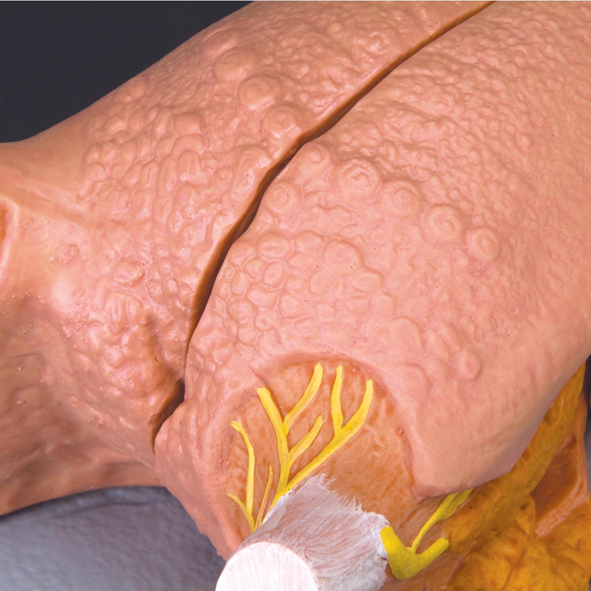 Tongue Model, 2.5 times Life-Size, 4 part