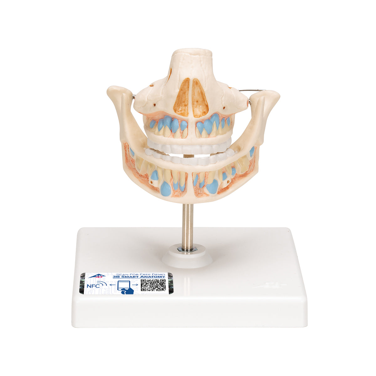 Milk Denture Model with Remaining Teeth