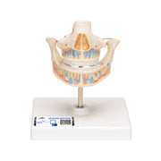 Milk Denture Model with Remaining Teeth