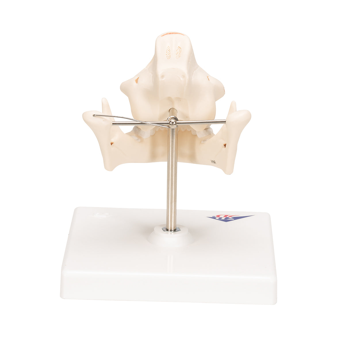Milk Denture Model with Remaining Teeth