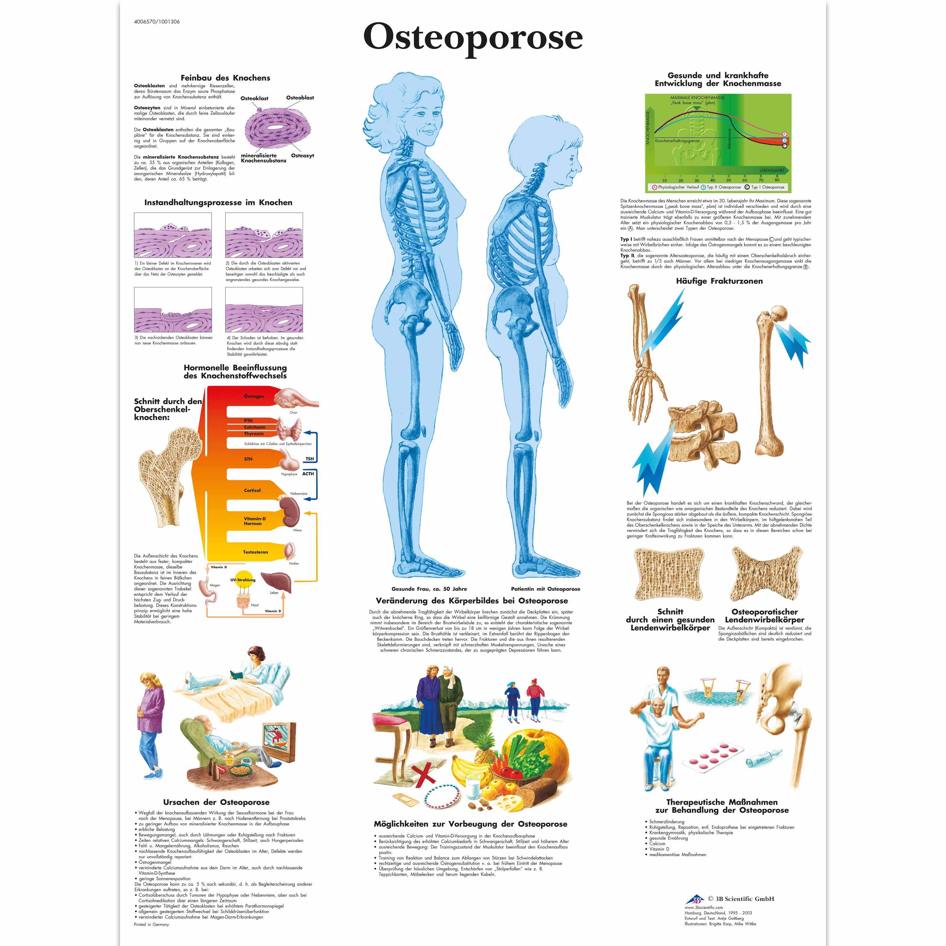 Osteoporose Chart