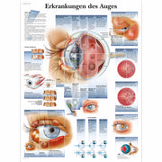 Erkrankungen des Auges