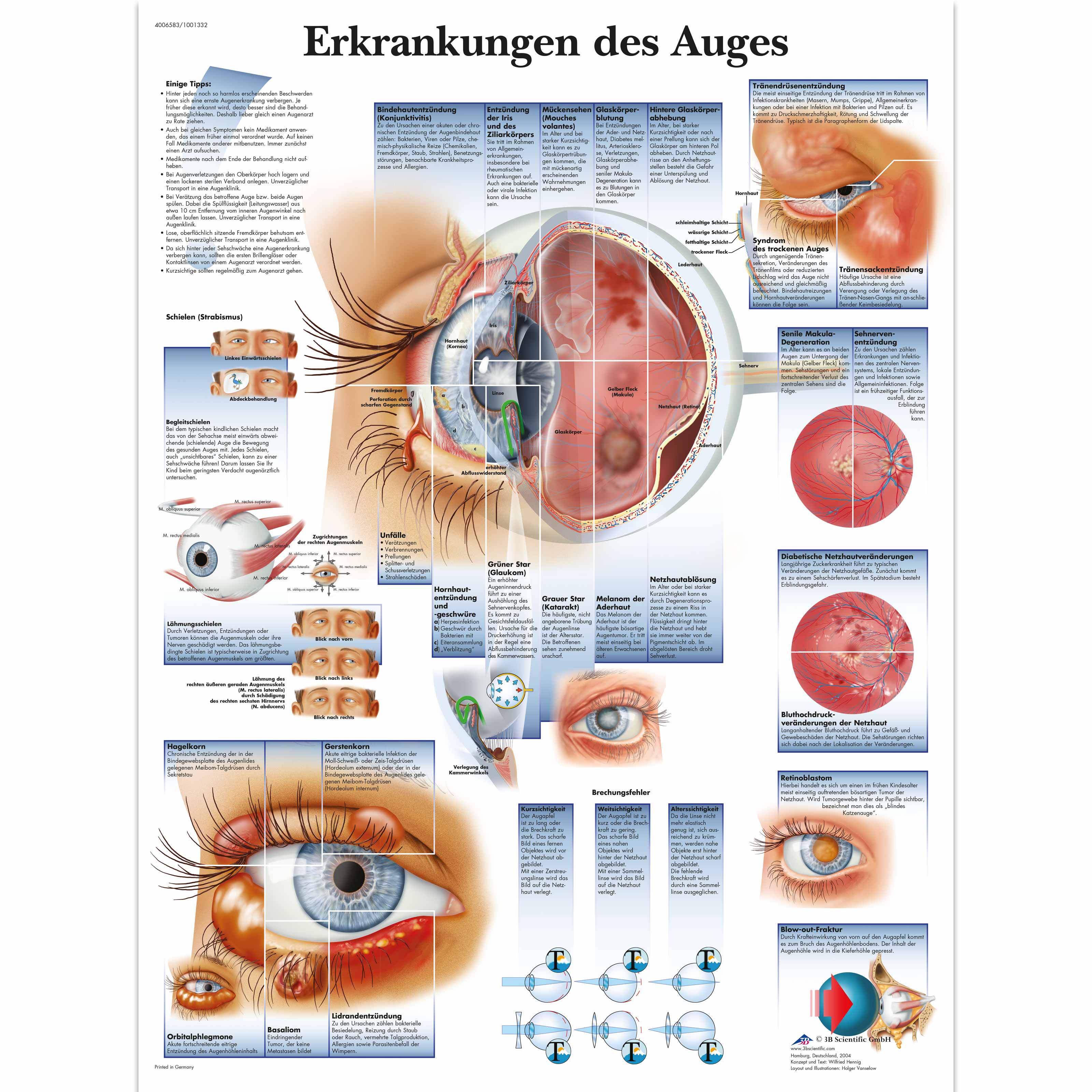 Erkrankungen des Auges