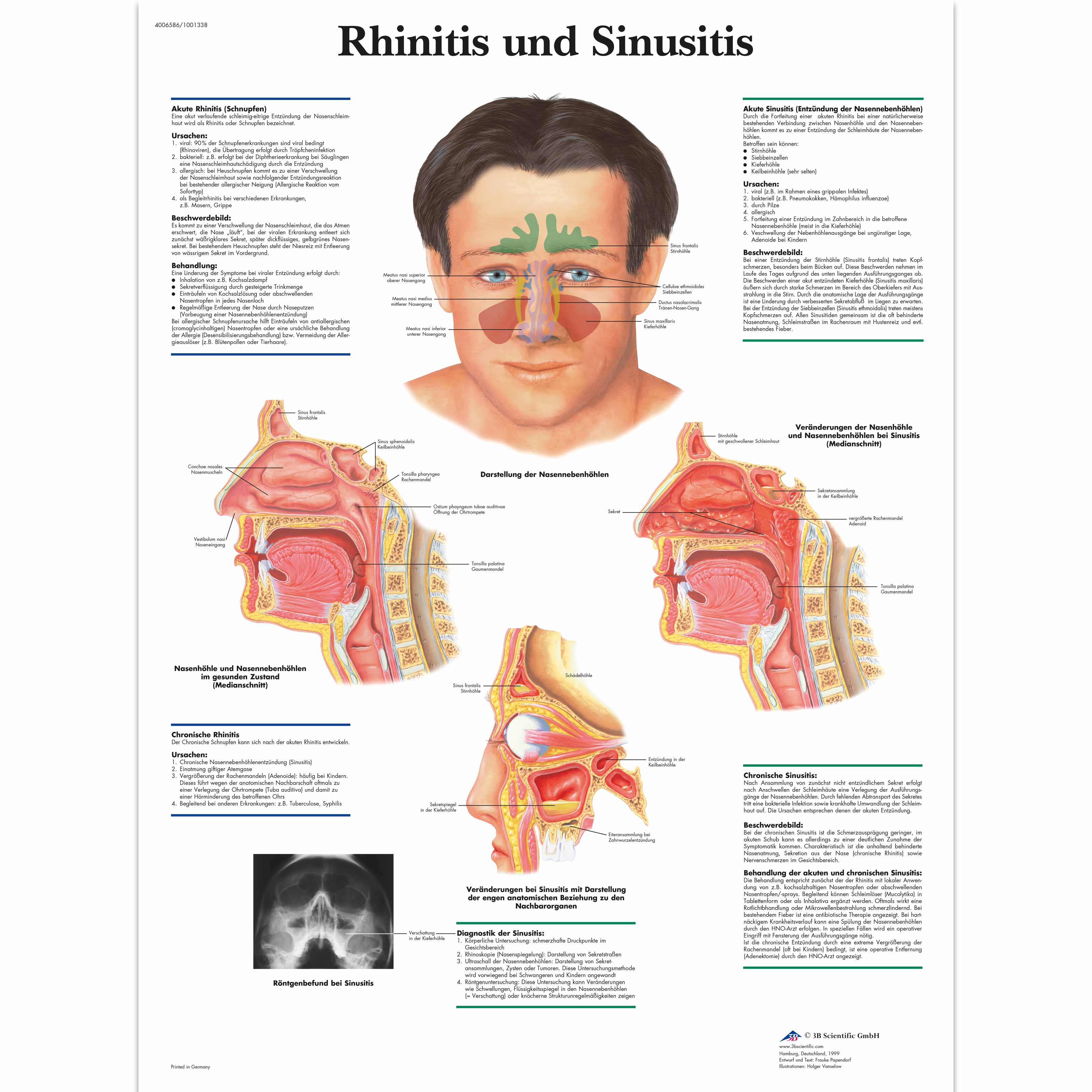 Rhinitis und Sinusitis