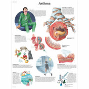 Asthma Chart