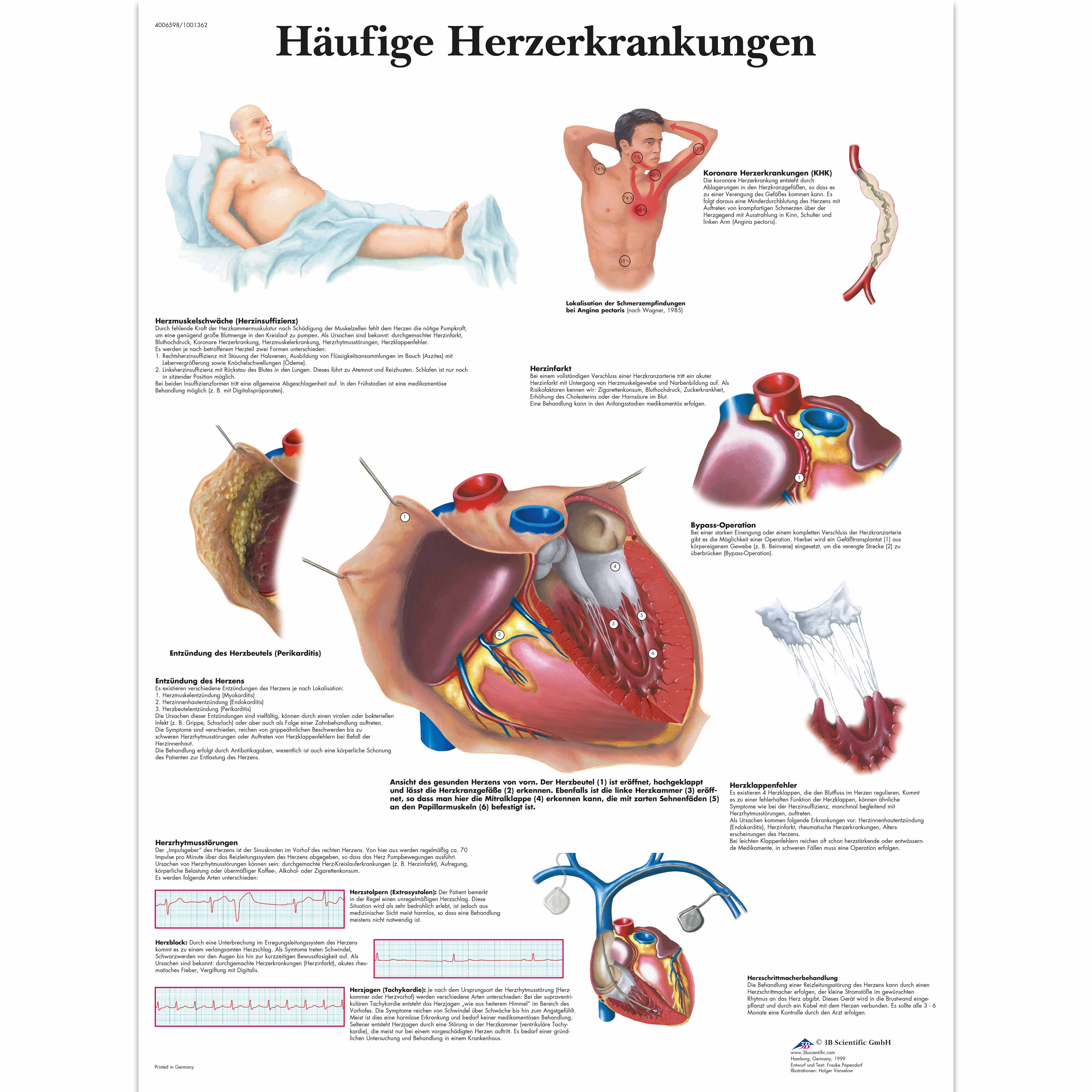 Häufige Herzerkrankungen