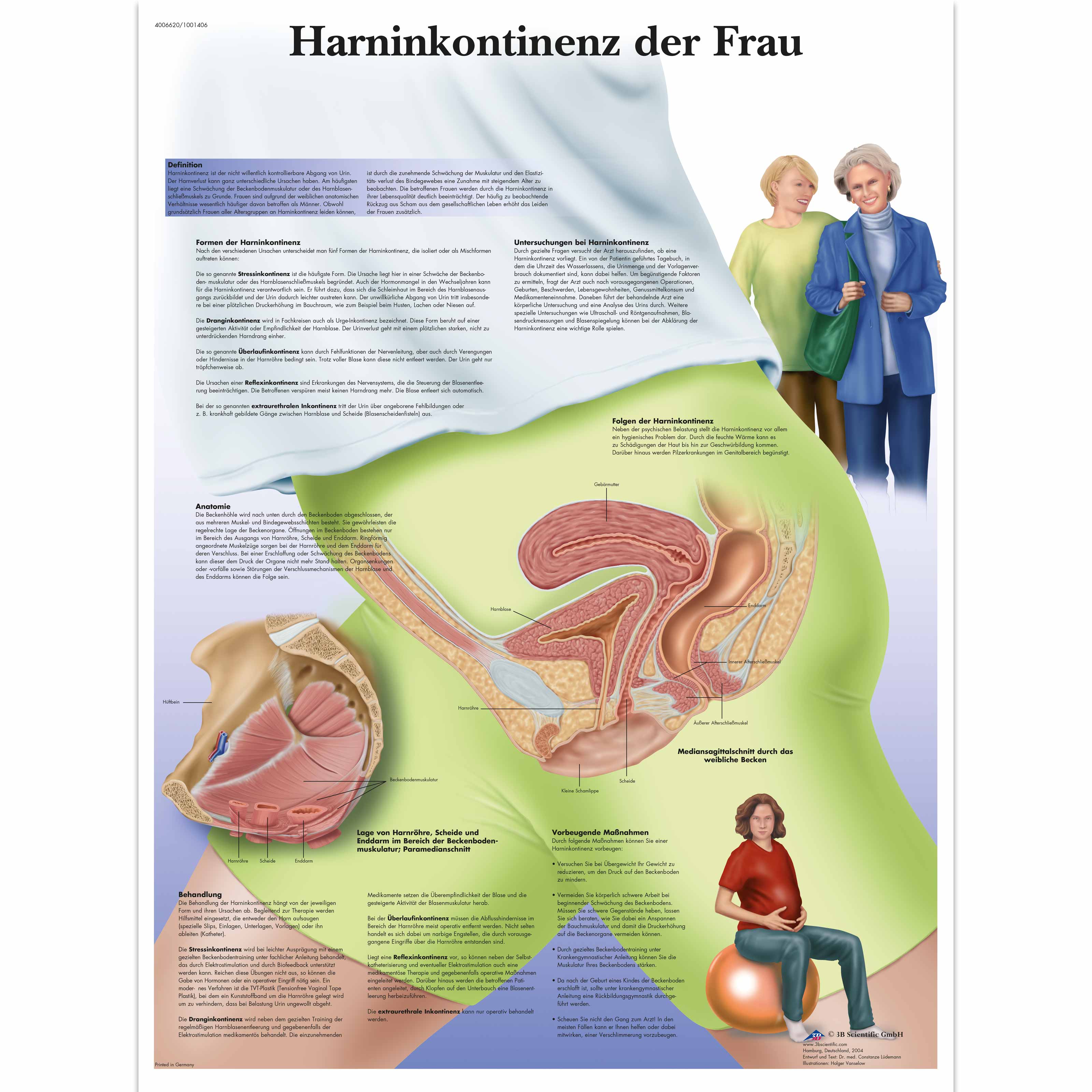 Harninkontinenz der Frau
