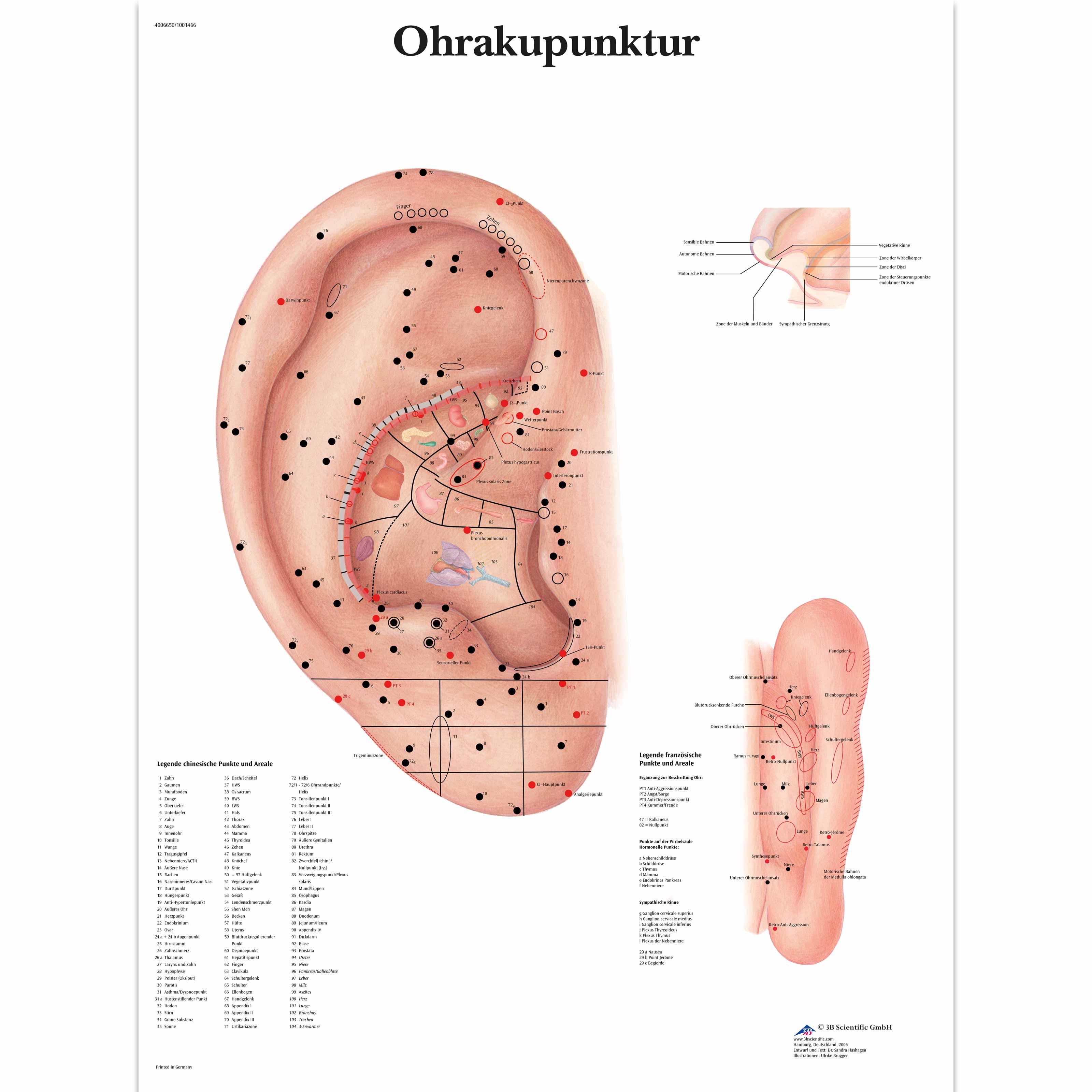 Ohrakupunktur