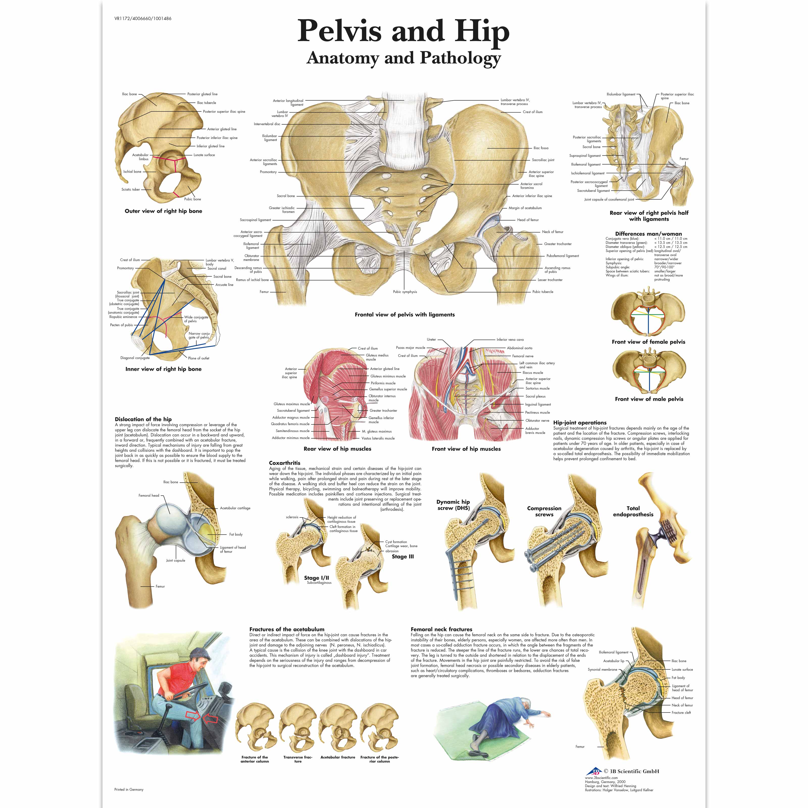 Pelvis and Hip Chart - Anatomy and Pathology