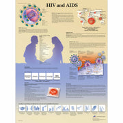HIV and AIDS