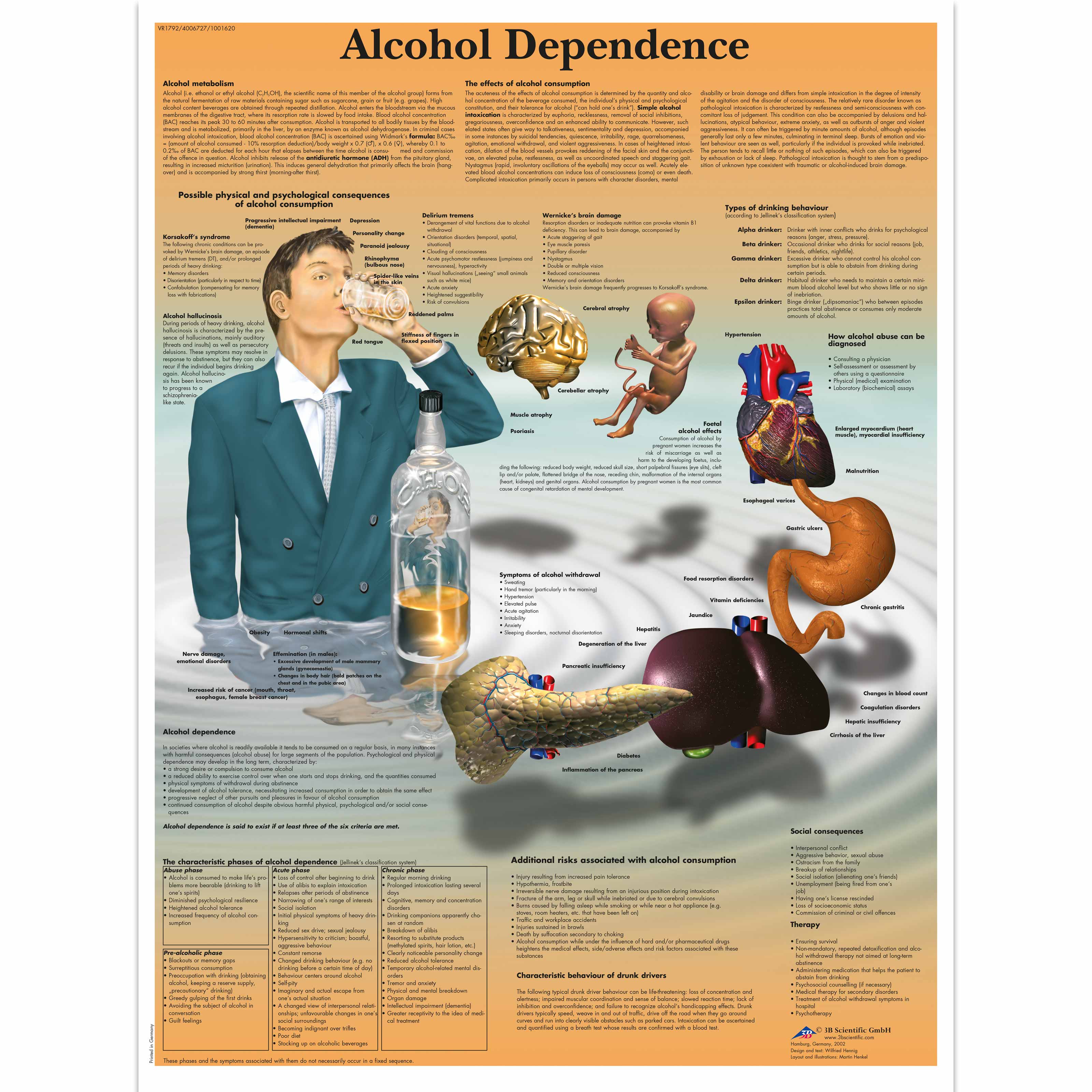 Alcohol Dependence