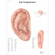 Ear Acupuncture