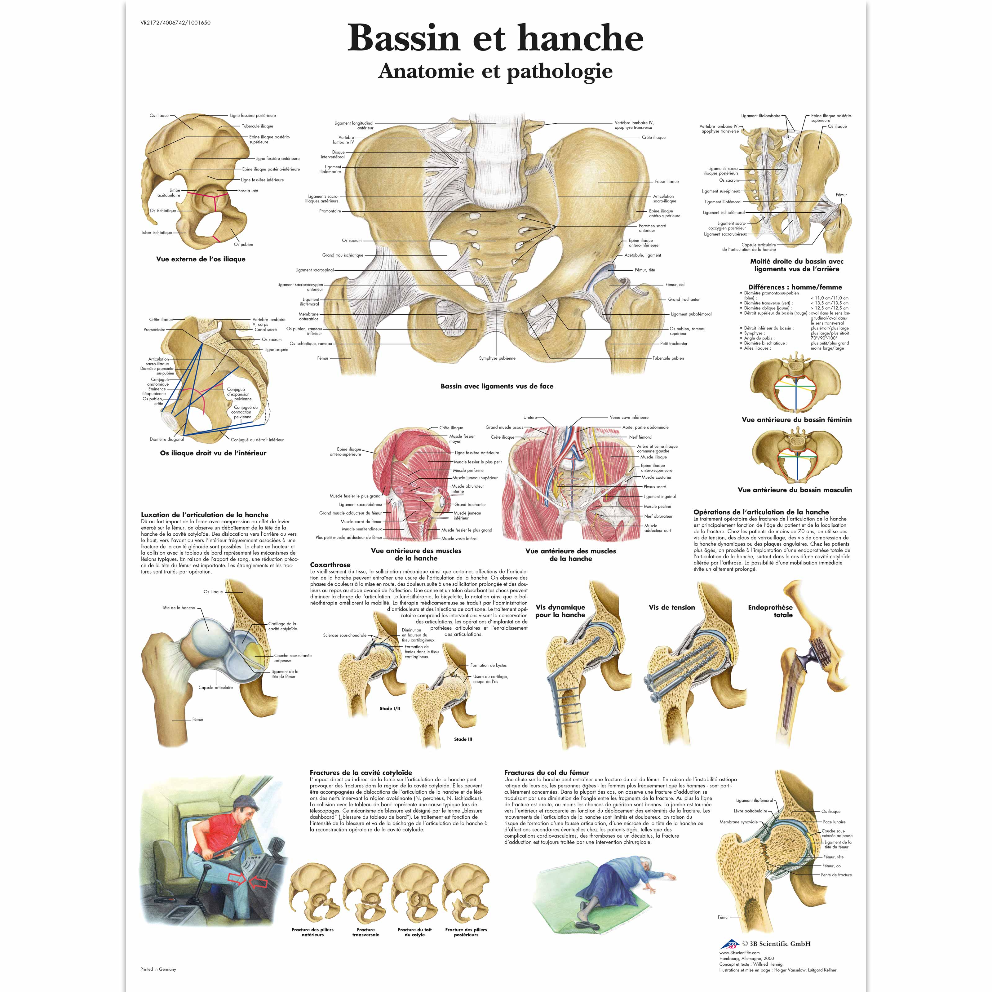 Bassin et hache - Anatomie et pathologie