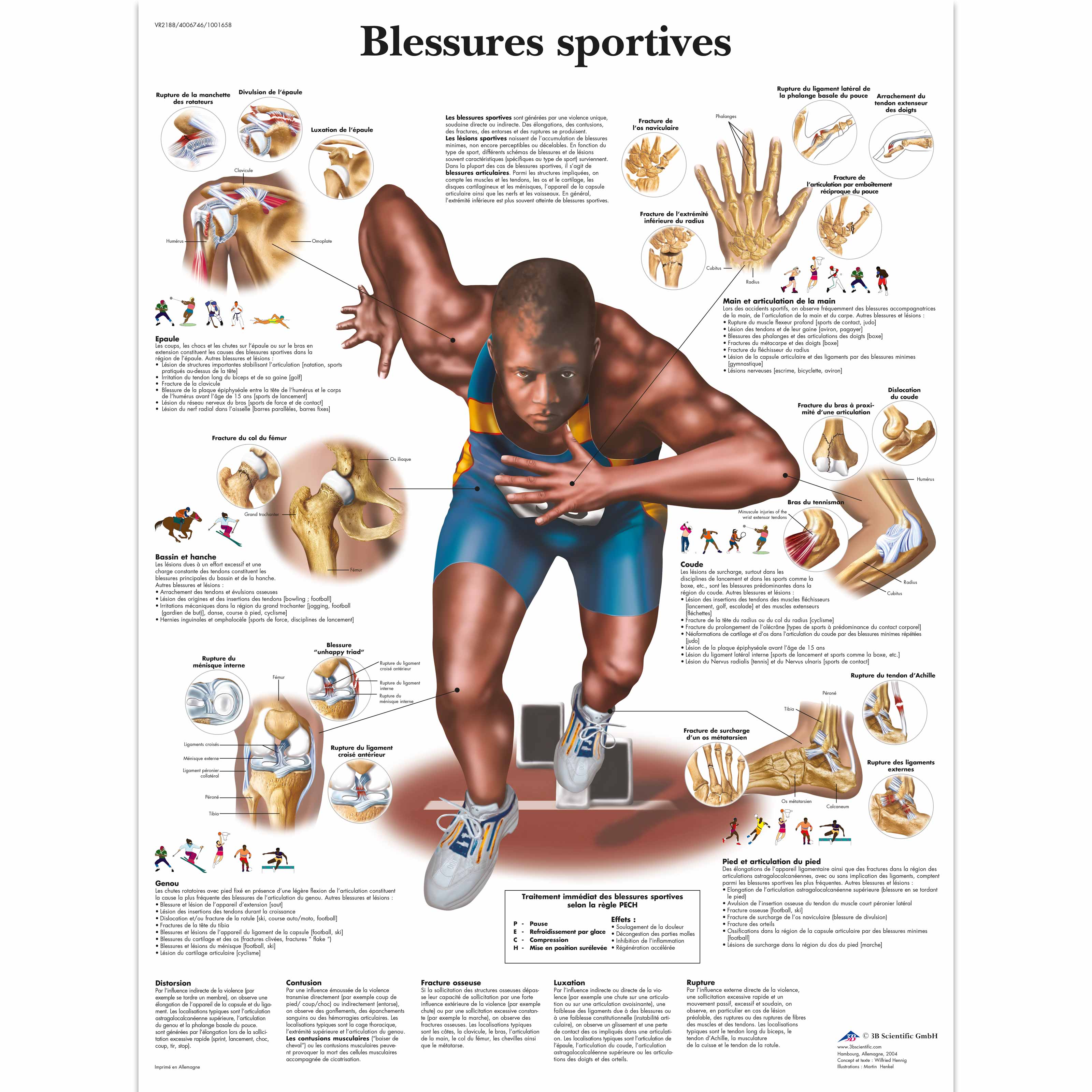 Blessures sportives