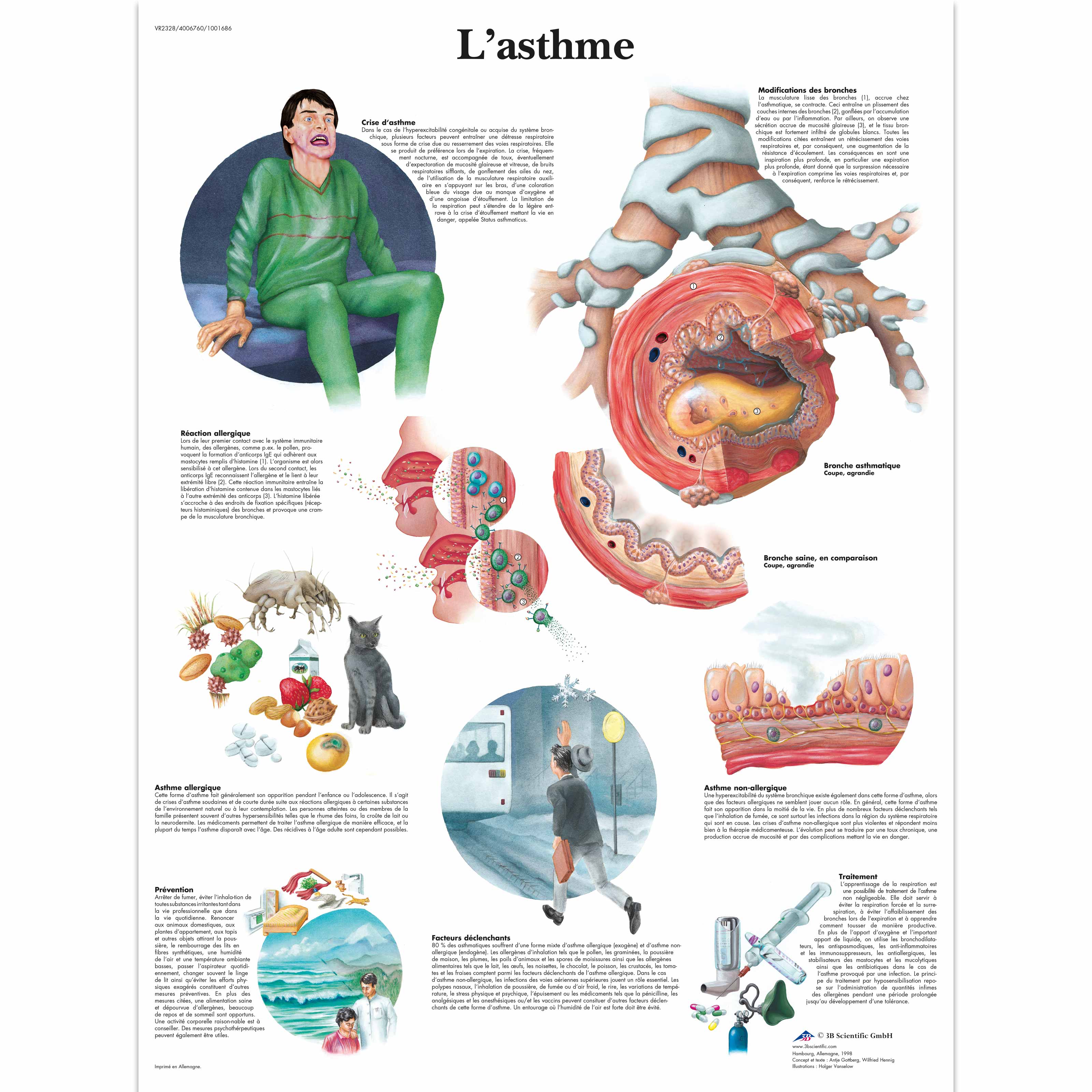 L'asthme