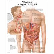 Affections appareil digestif