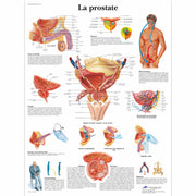 La prostate
