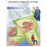 Incontinence urinaire Femme