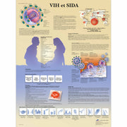 VIH et SIDA