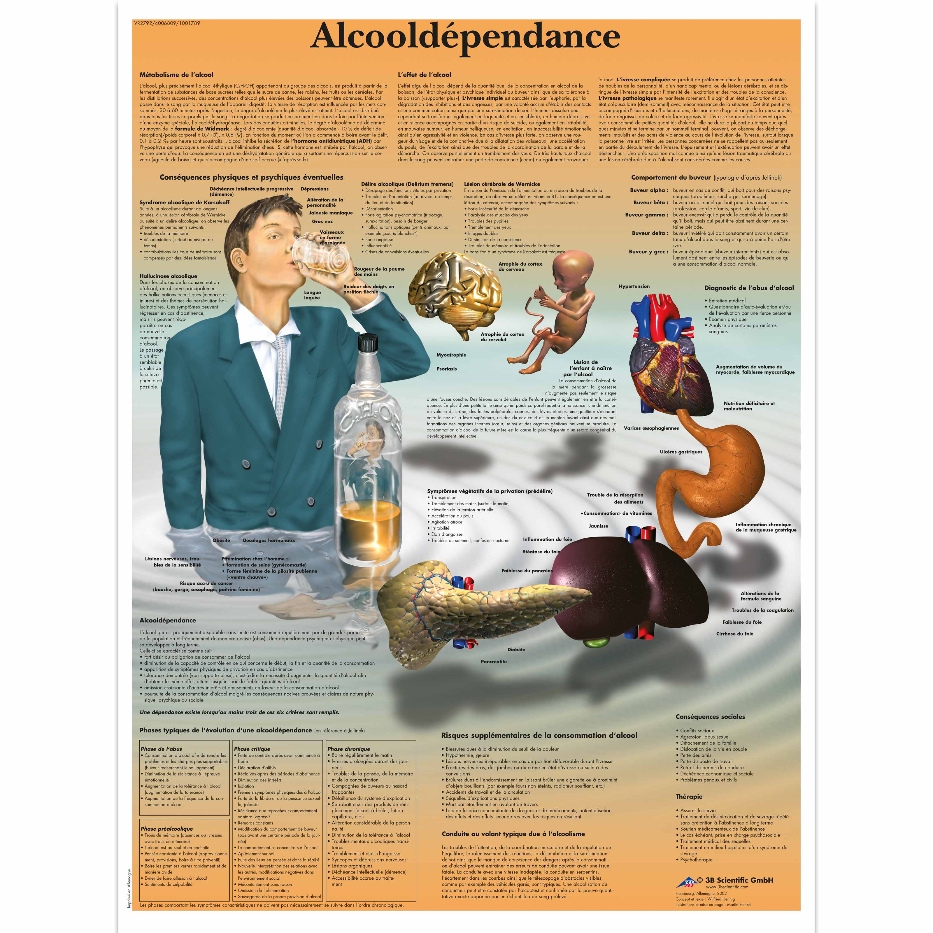 Alcooldépendance