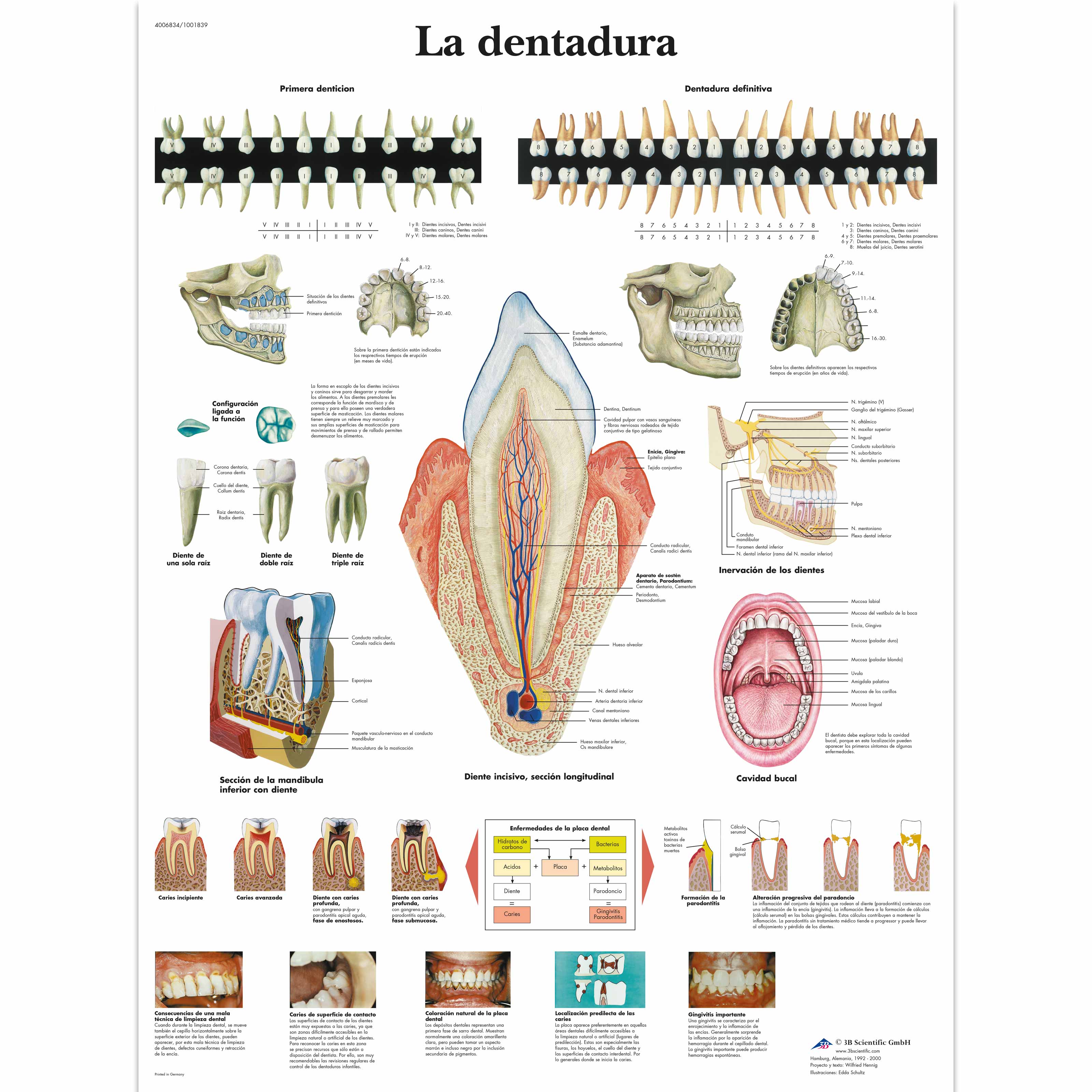 La dentadura