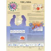 HIV y AIDS