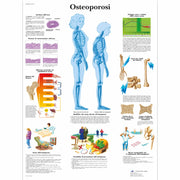 Osteoporosi