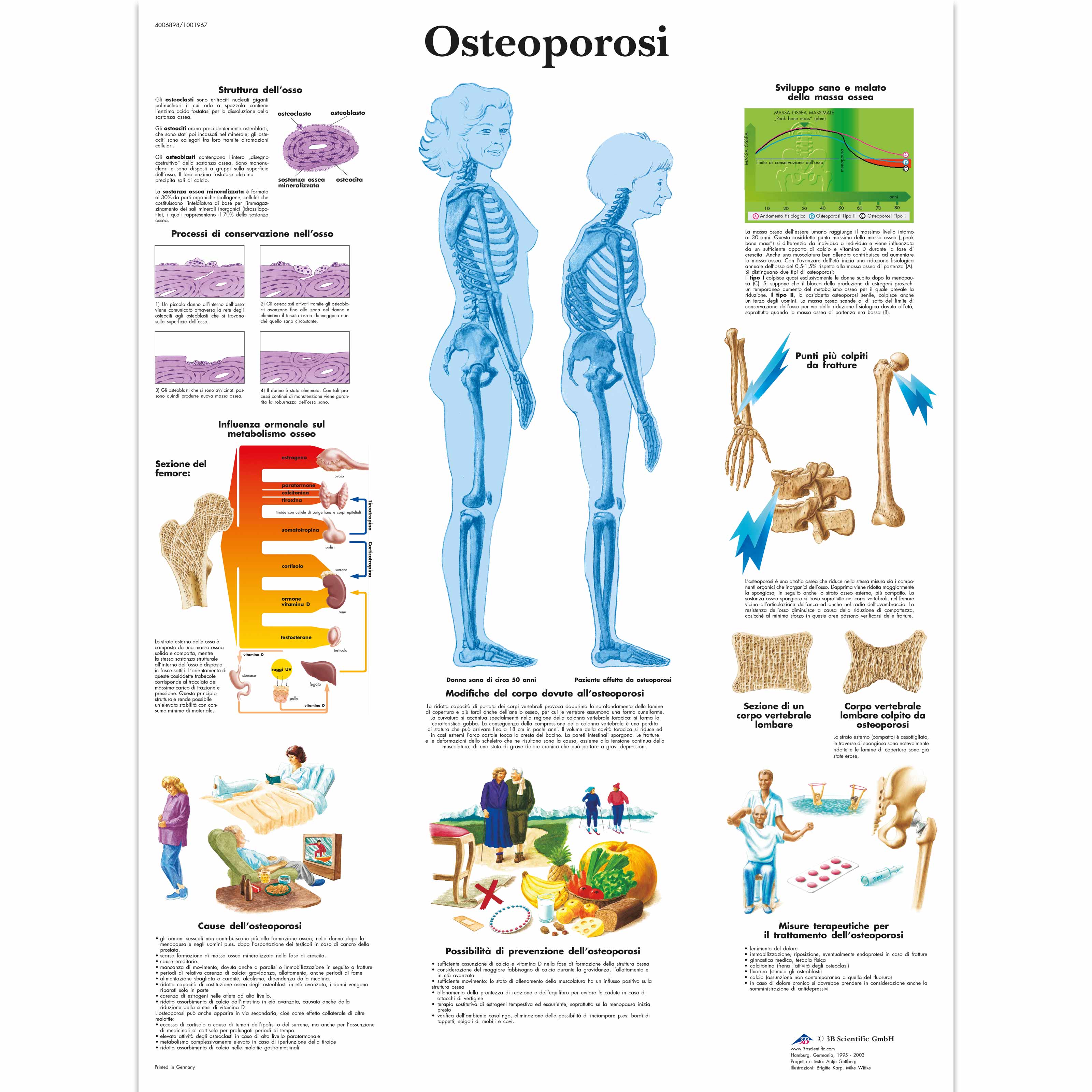 Osteoporosi