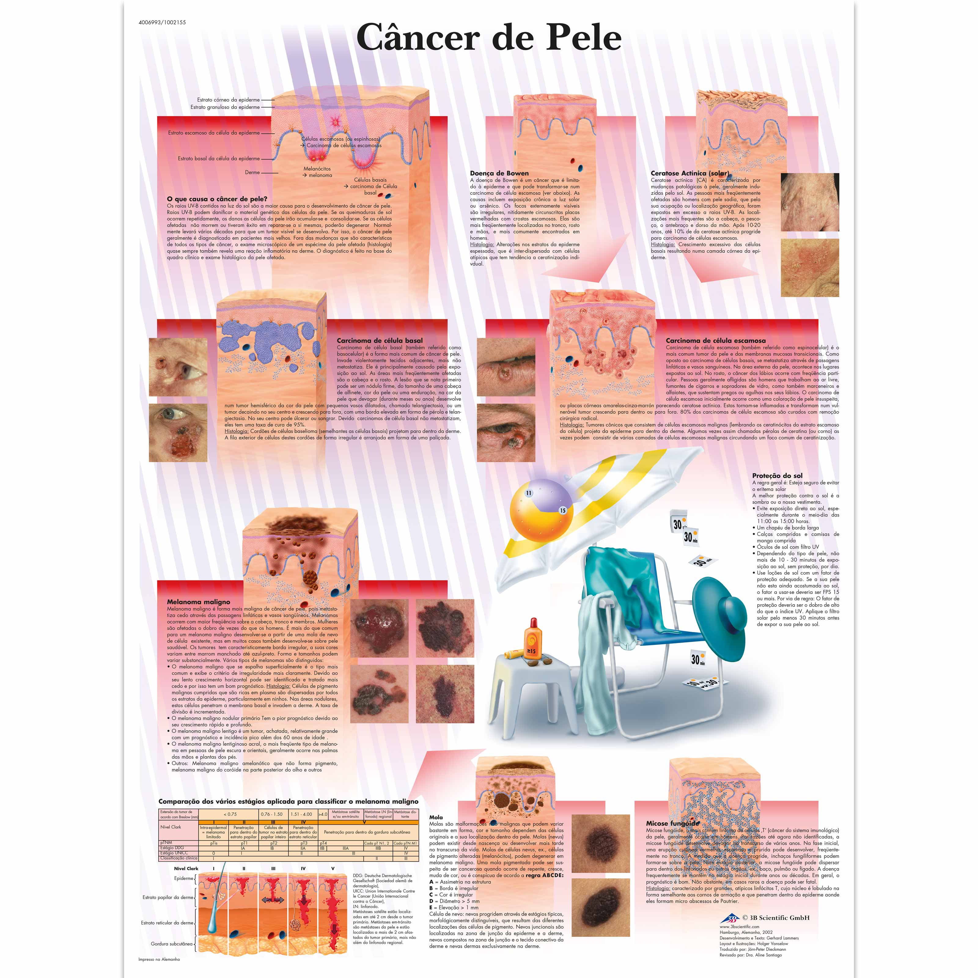 Câncer de Pele