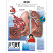 DPOC