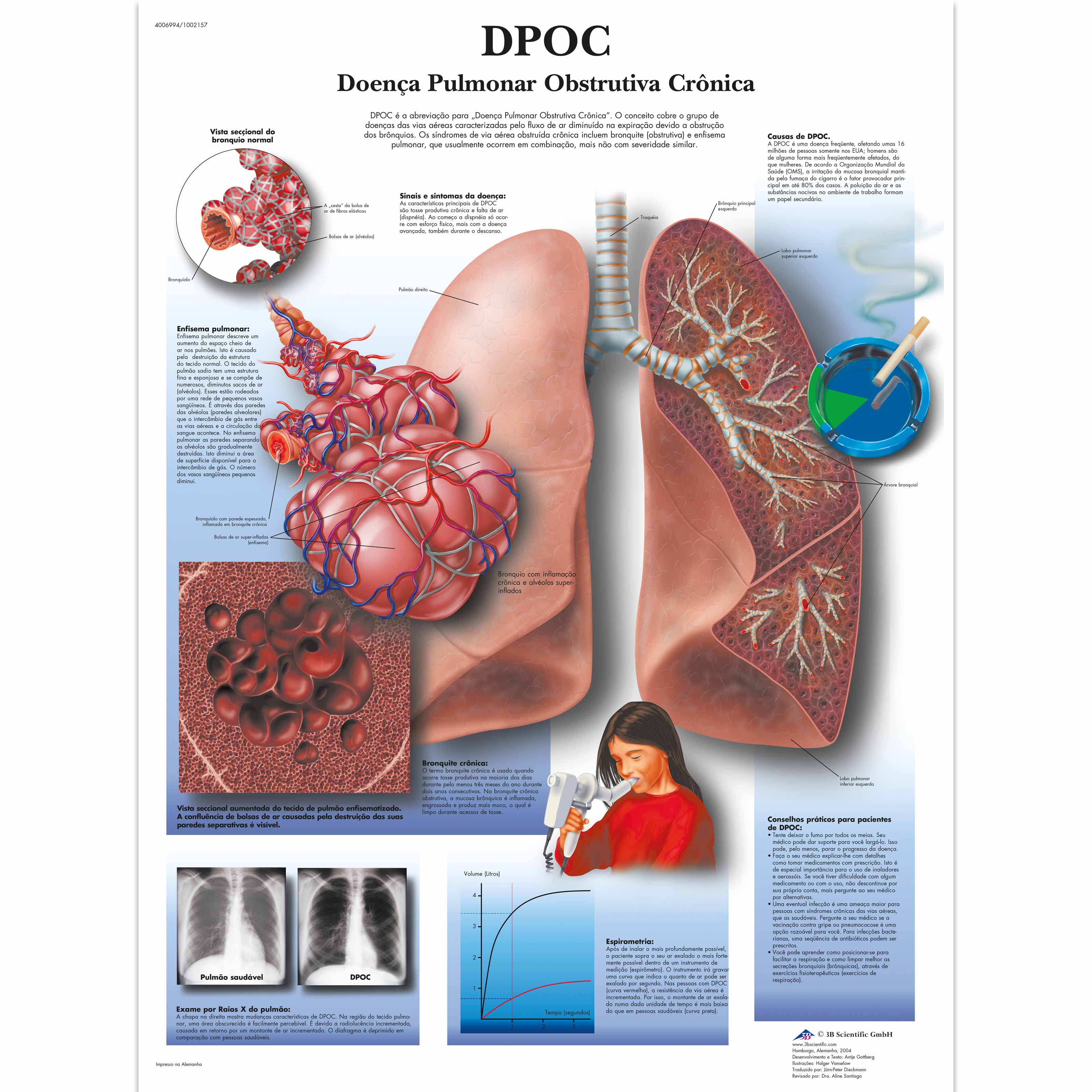 DPOC