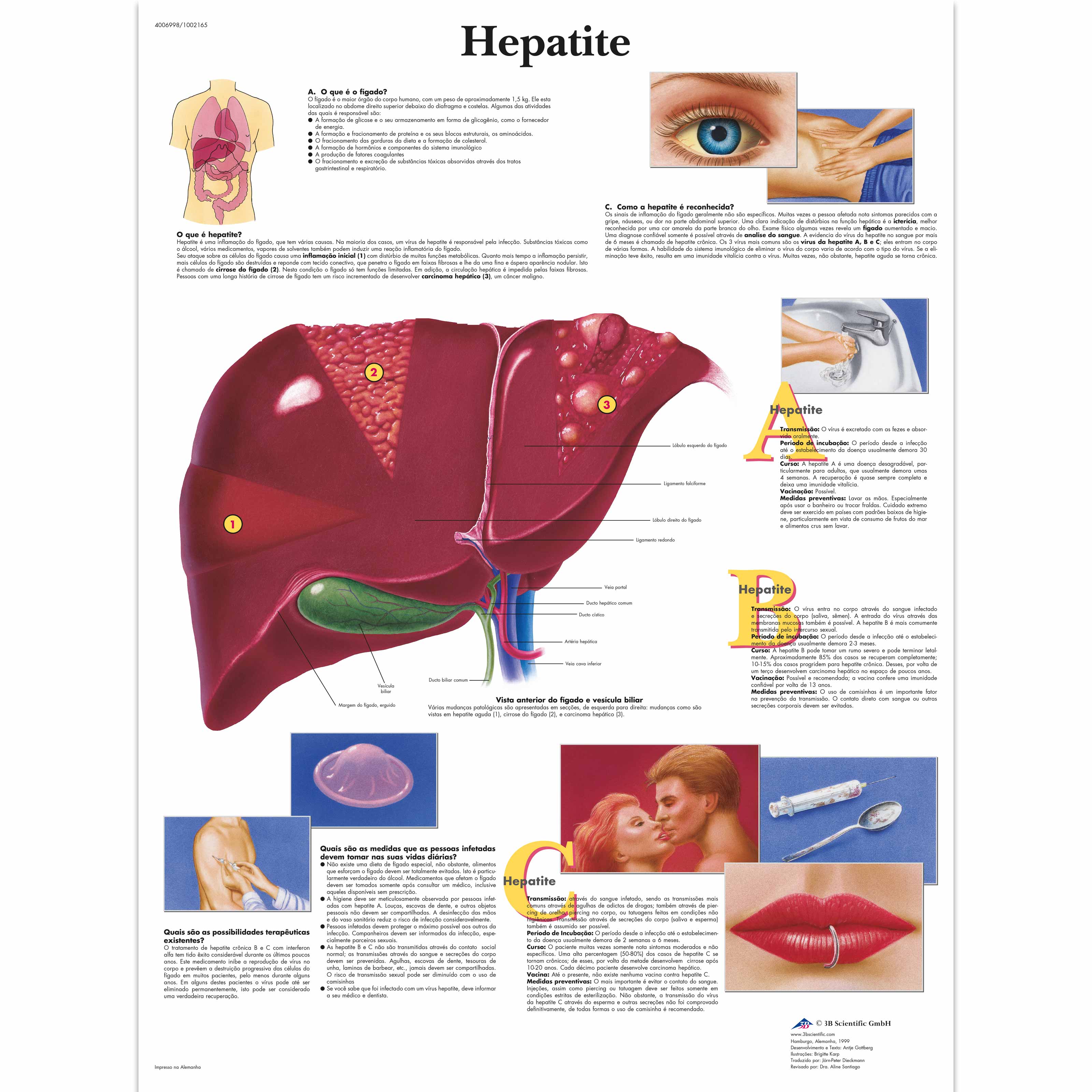 Hepatite, 50x67 cm, Laminado