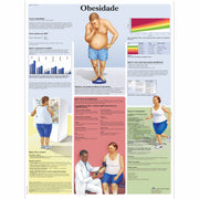 Obesidade