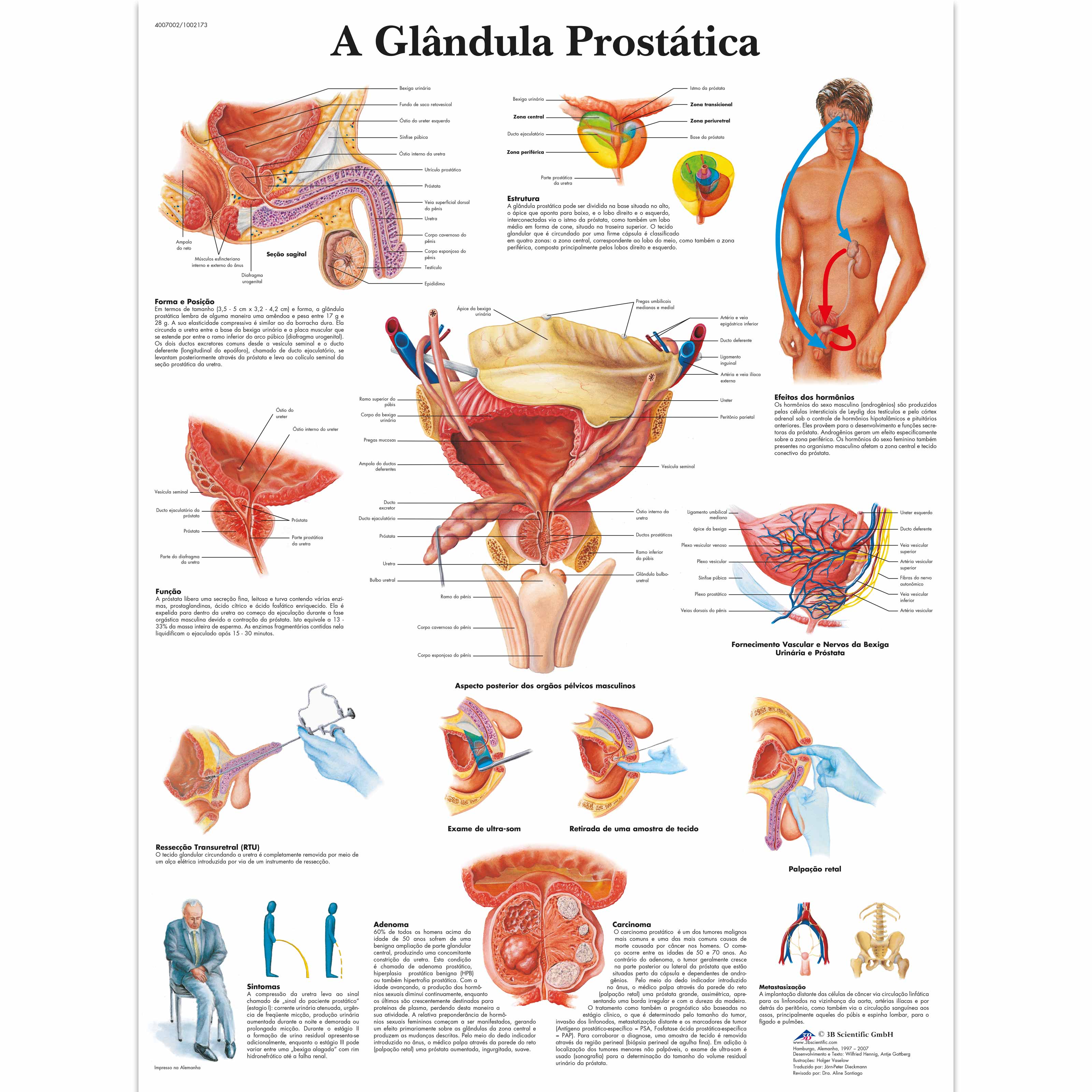 A glândula Prostatica, 50x67 cm, Laminado